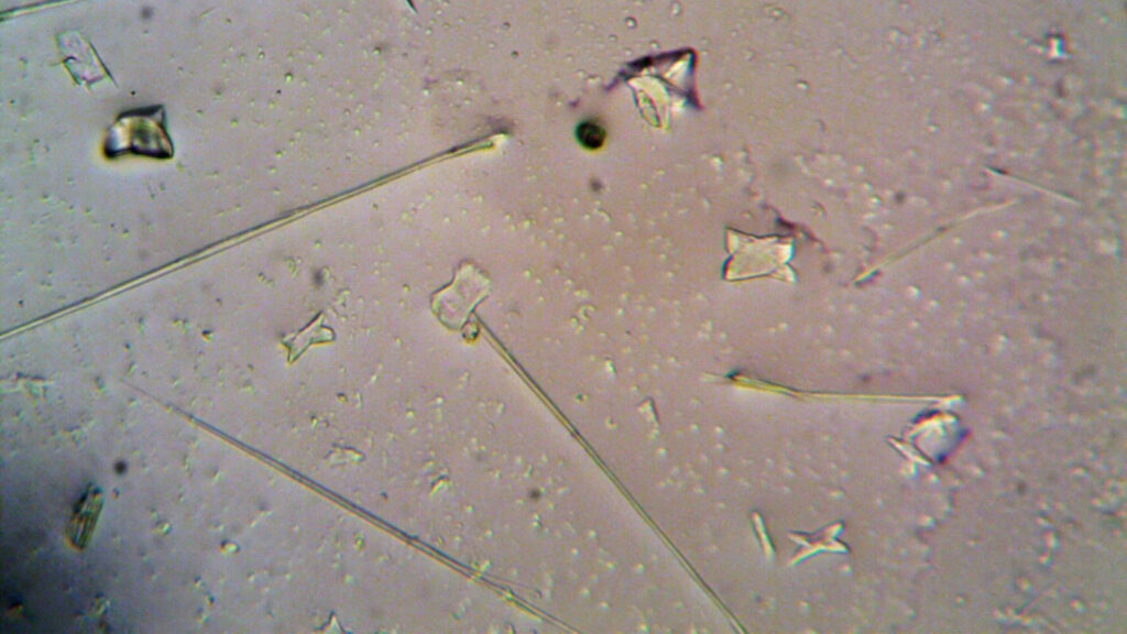 Imagem representativa de vida celular precoce ao microscópio. Imagem: Pexels